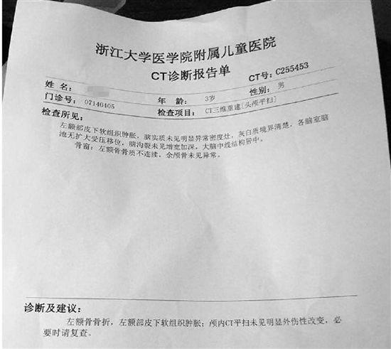 经浙大儿院诊断,小华额骨骨折.