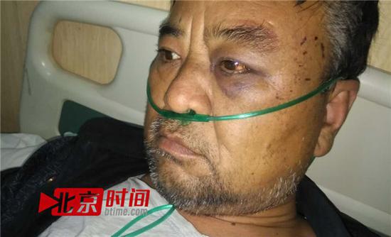 村民被打伤左眼 图/北京时间