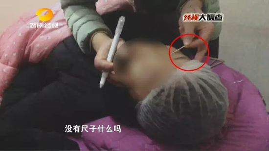 刘老师用牙签测量所需双眼皮宽度