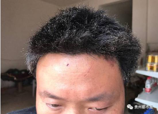 三星爆炸手机型号