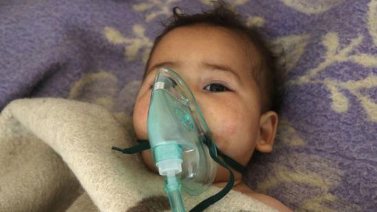 袭击后，一名叙利亚儿童在Maaret al-Noman镇接受治疗（图片来源：英国天空新闻网站）