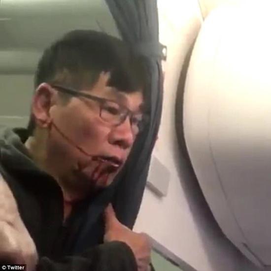 在美联航航班上遭遇暴力对待的亚裔男子。