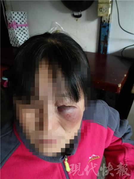 被打的吴女士 警方供图