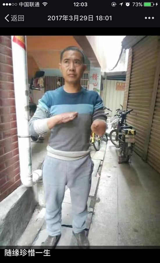 王忠馗受伤4个多月后，妻子拍下照片并配文“随缘珍惜一生”。  受访者供图