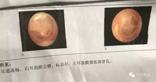 李姐诊断结果