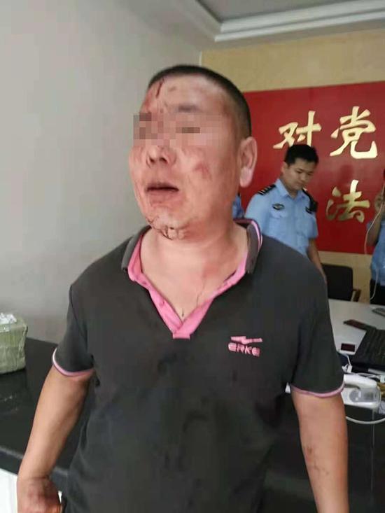 巩先生在自己的门店内被多名城管打伤。当事人供图