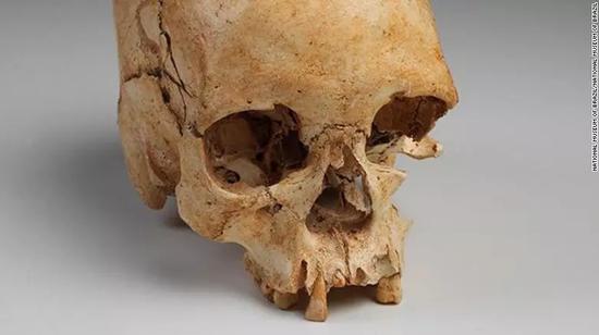 △博物馆的人类化石“卢西亚（Luzia）”