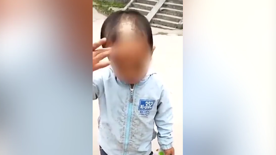 视频-深圳再现疑似虐童事件：男孩眼角淤青头发脱落