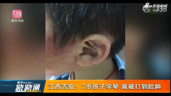 视频|三个音节奏弹不对 7岁男孩被老师打肿脸