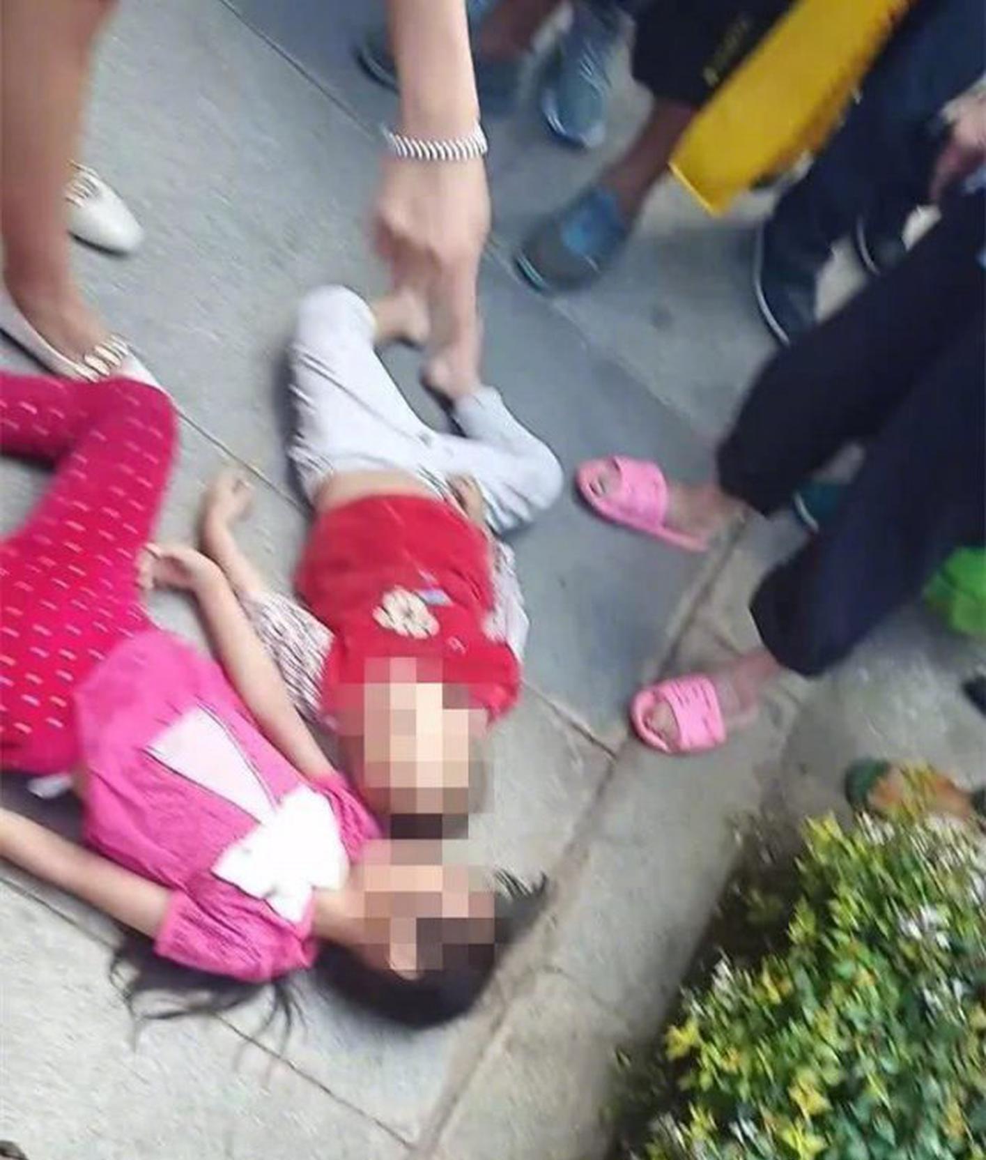 什么食物对脑梗有好处