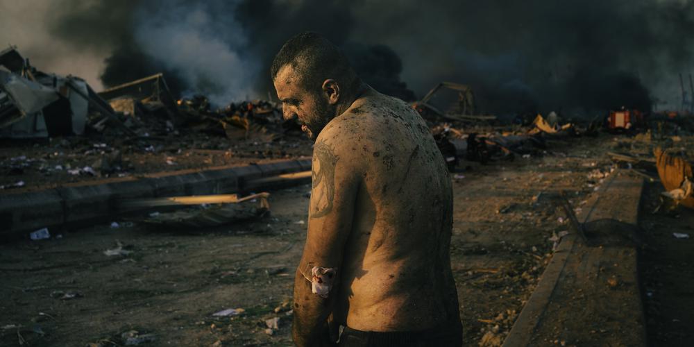 第64届荷赛揭晓：每一幅都记录着2020的伤与痛