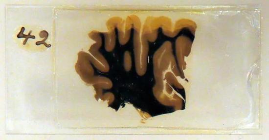 2012年3月27日,爱因斯坦的大脑玻璃切片在伦敦韦尔科姆收藏馆(Wellcome Collection)展出。