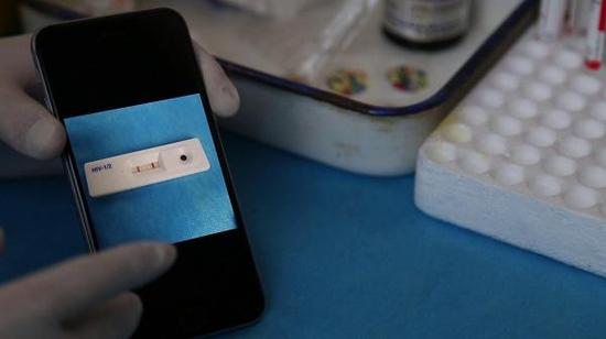“防艾”公益组织在初筛中发现的”阳性“HIV感染者,快速试纸检查会呈现两道红线。