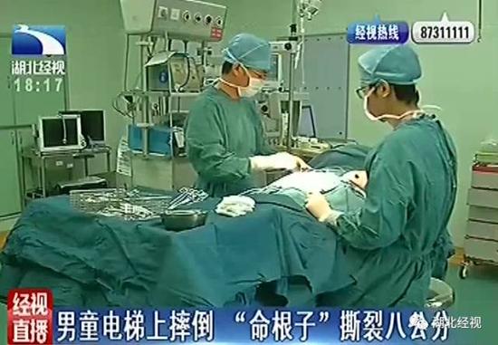 1岁半男童在这里摔倒 命根子被严重撕裂(图)