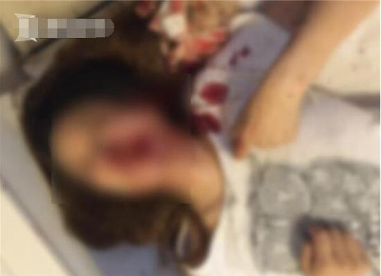 重庆晨报:女子酒后遭同事强吻 被男友误以为出轨遭暴打(图)