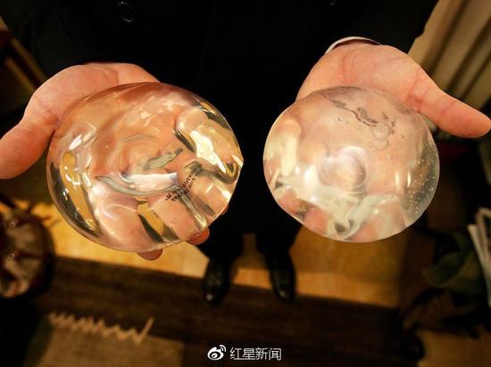 乳房假体 图据Getty Images