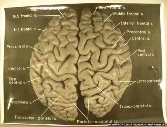 哈维当年拍摄的爱因斯坦大脑照片,现存于美国健康医药博物馆。图片来源:NMHM