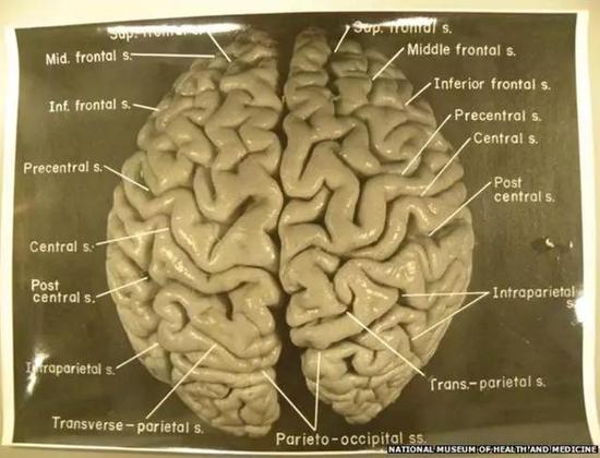 哈維當年拍攝的愛因斯坦大腦照片，現存於美國健康醫藥博物館。圖片來源：NMHM