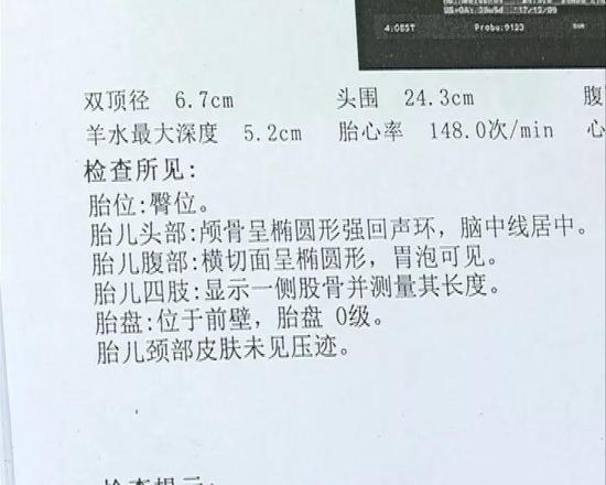 从刘先生提供的检查单可以看到，每次B超都没有提示胎儿有异常。