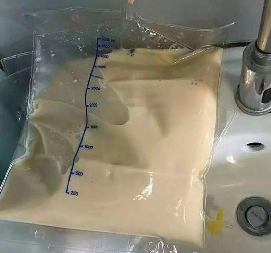 (图:小琳的血浆颜色)