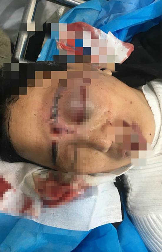 事发后保育员被送医。