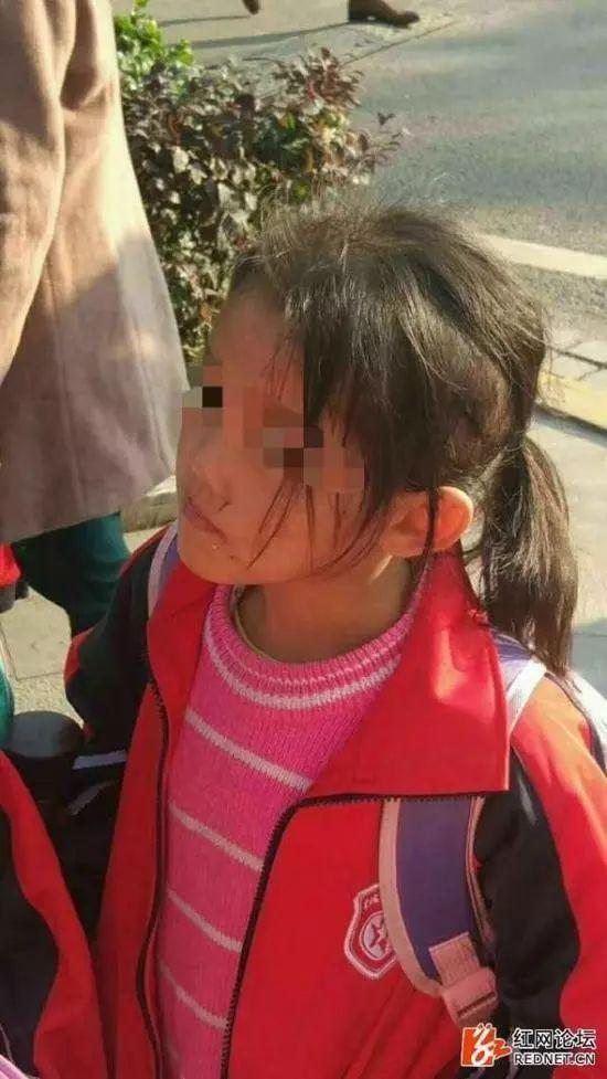 女孩被母亲虐待