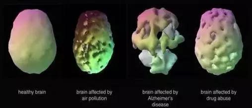 图一是健康的大脑，图二、三、四依次为被空气污染、老年痴呆症以及毒品侵蚀的大脑。