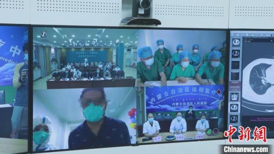 图为内蒙古新冠肺炎医疗救治专家组对确诊患者佟某某进行远程会诊。 张玢 摄