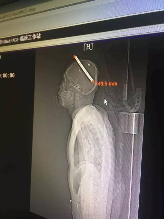 坎 贝 奇 做爱 视频