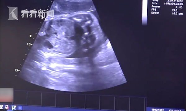 Fuck丰满老货Hd泻火