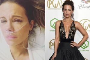 45岁英国女星凯特·贝金赛尔前日于个人社交网站上传一张看病照片。