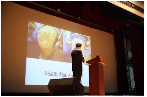 扁康韩医院徐孝锡代表院长在首尔巡回演讲中通过治疗实例讲解过敏性皮炎发病原因及治疗方法。