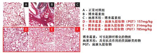 通过实验结果显示,扁康丸可有效抑制因空气污染诱发的气道粘液分泌过多以及肺纤维化疾病。