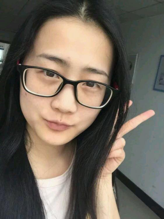 用了黛芙薇尔三个月雀斑就淡下去了,真的很开心O(∩_∩)O~~