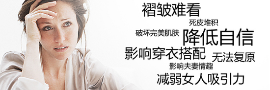腿上的妊娠纹还能去掉吗?去除腿上妊娠纹的办法