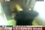 保安遭惡犬連續(xù)攻擊 面部縫了218針
