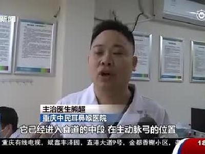 视频｜边打电话边吃鱼 大妈险因鱼刺卡喉丢了性命