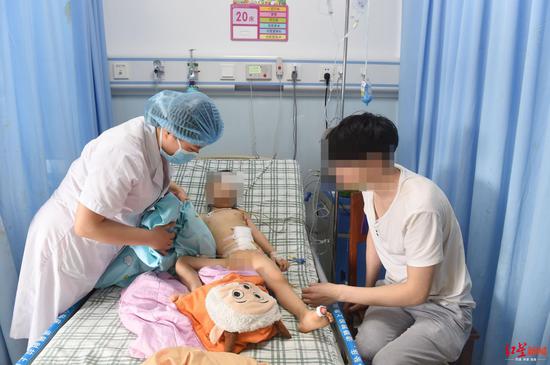 ↑手术完成,顺利将巴克球取出
