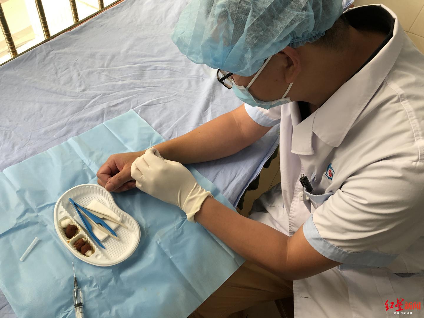↑曾江華表示,使用微創手術,康復更快