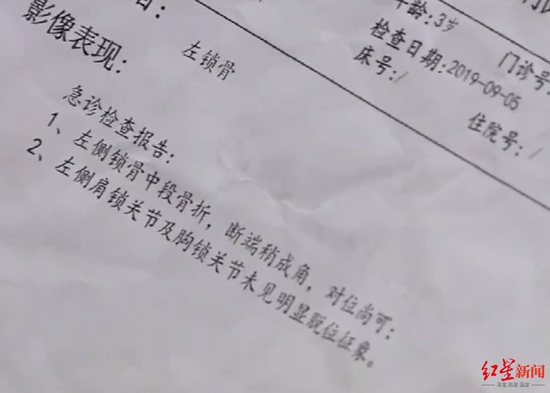 ↑小孩骨折診斷報告