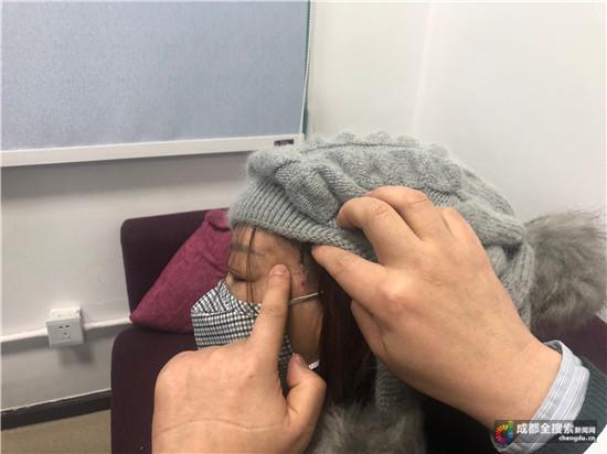 糟心:十多年前随意选择医美项目种下祸根