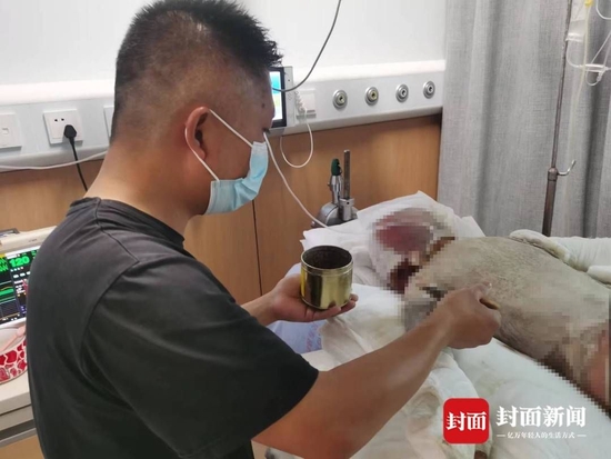 李伯峰給孩子涂抹藥物