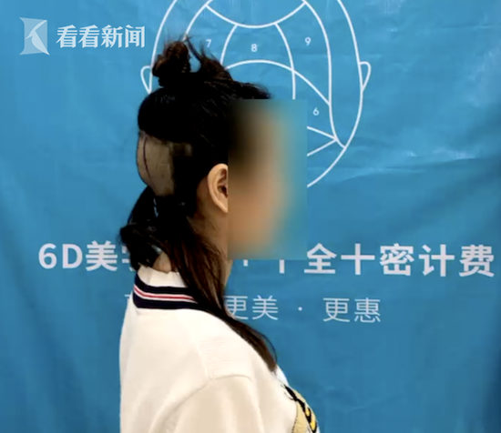 美女被剃秃头 却因抑郁症被告知不能做植发手术