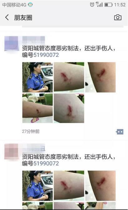 9月11日资阳人的朋友圈,被一条“城管执法出手伤人”的信息刷了屏。