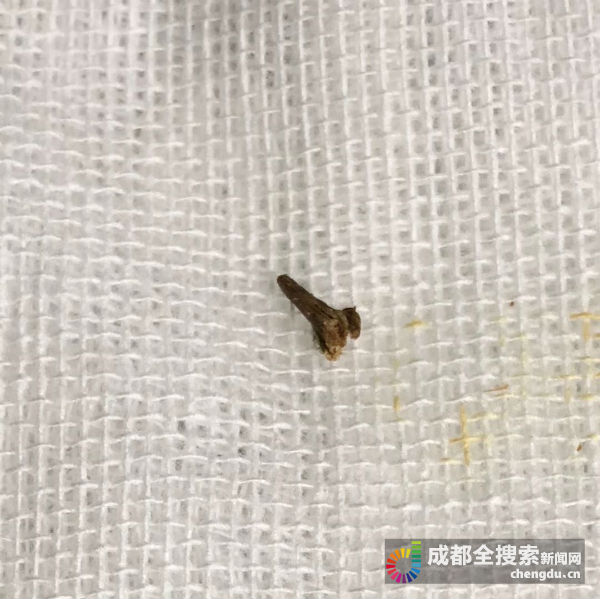 被串串竹签戳破了手指