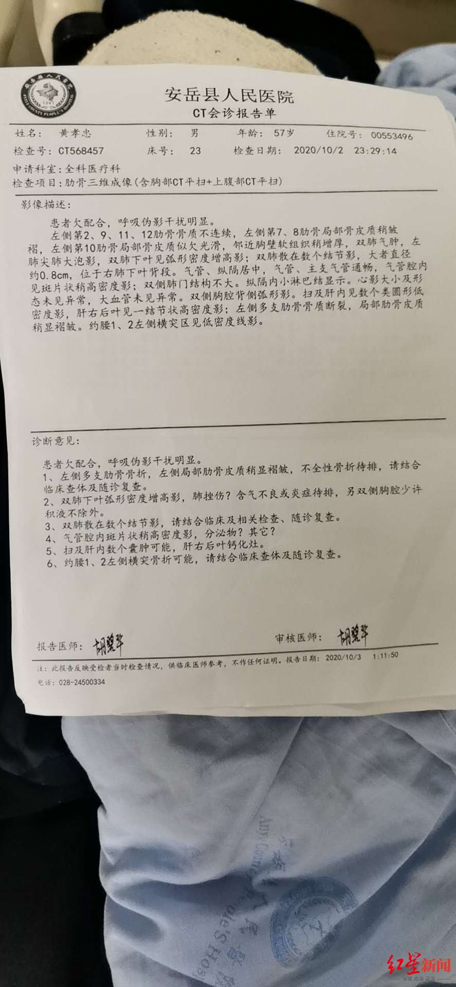 ↑黃孝忠在醫院的CT會診報告單。