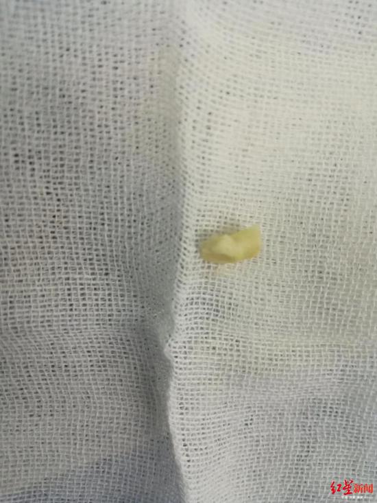 被取出的花生米