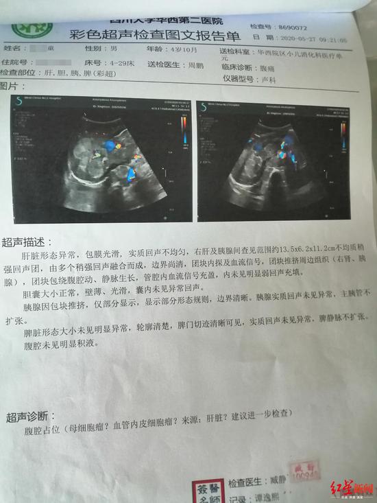 彩超图文报告单