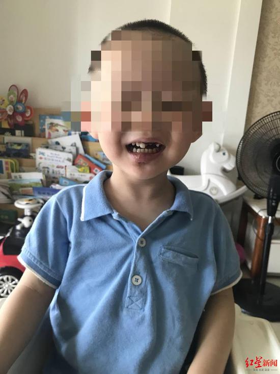 孩子目前傷情