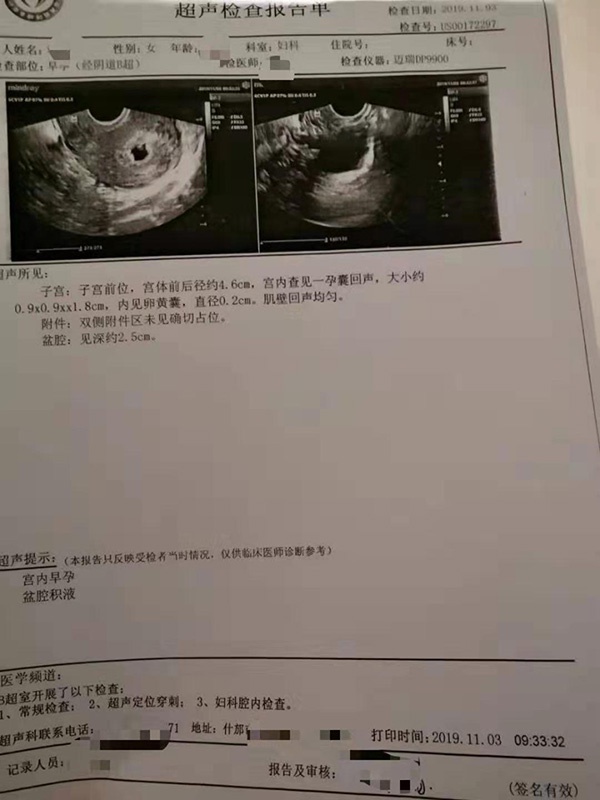 医院B超显示蒋女士已怀孕